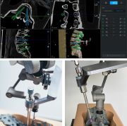 Cyber Surgery